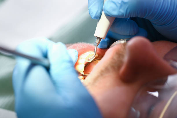 Best Emergency Root Canal Treatment in Sunset, UT