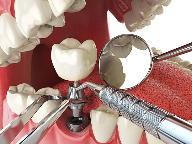 Best Broken or Cracked Tooth Emergency Dentist in Sunset, UT
